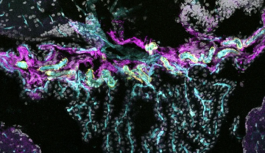 Newly identified barrier cells seal off choroid plexus from CSF, rest of brain