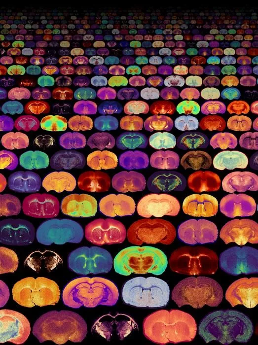distinct metabolites in brain sections