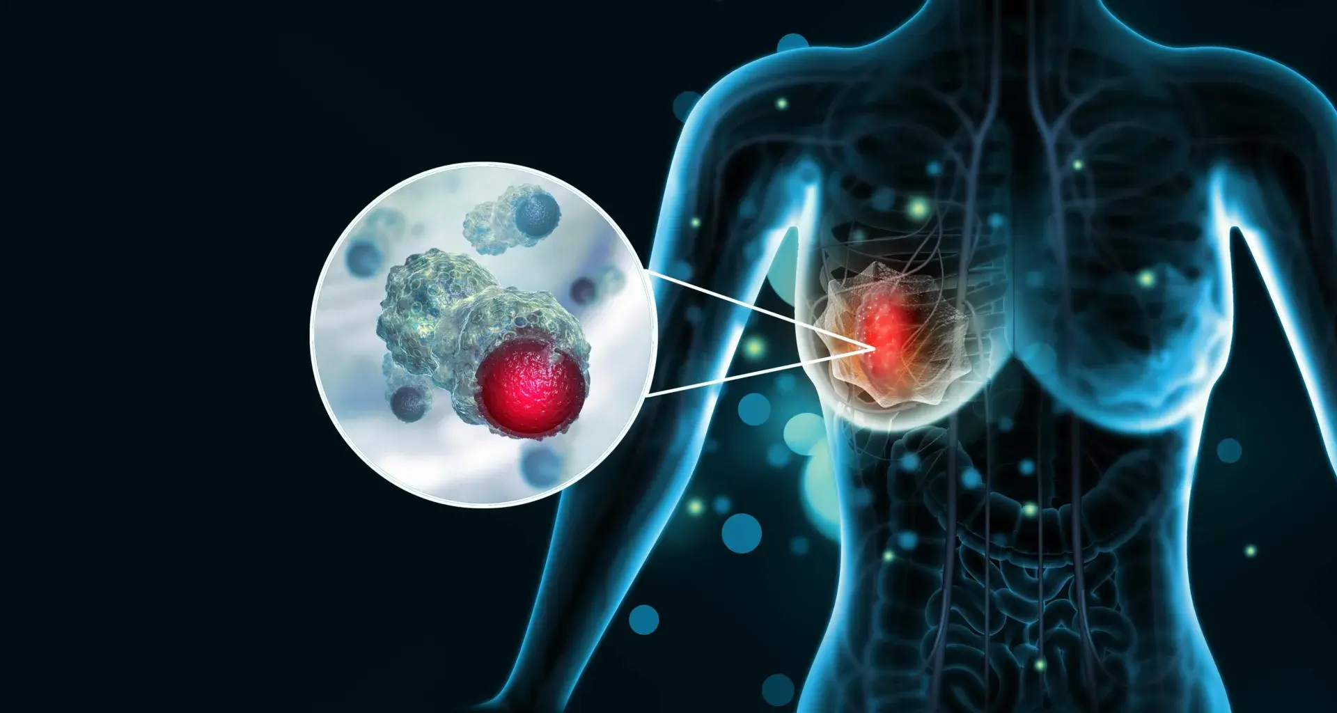 How aggressive breast cancer turns off the immune system