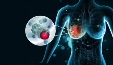 How aggressive breast cancer turns off the immune system