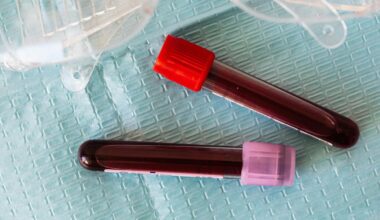 How CAR-T cell therapy could be made accessible to more patients