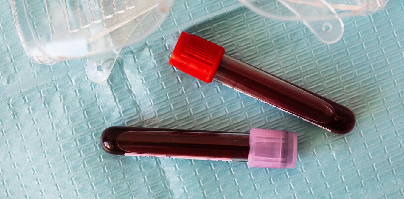 How CAR-T cell therapy could be made accessible to more patients