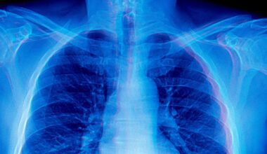 Frontier AI Models Are Doing Something Absolutely Bizarre When Asked to Diagnose Medical X-Rays