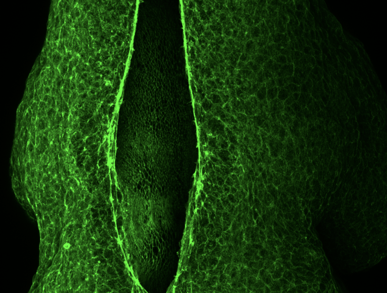 The Physics of Brain Development: How Cells Pull Together to Form the Neural Tube