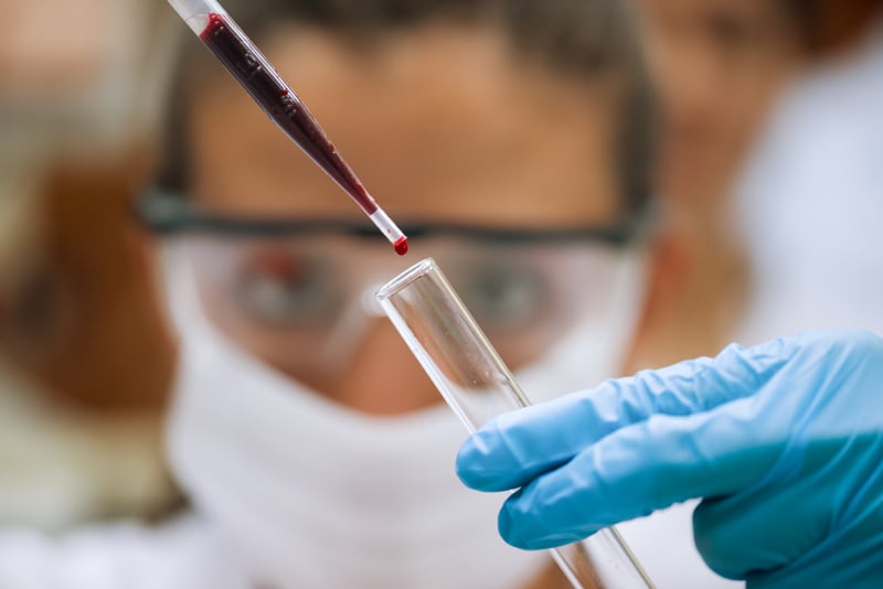 Researchers Develop Blood Test That May Detect Testicular Cancer Missed by Standard Markers