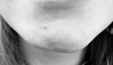 Navigating Huntington’s Disease as a Caregiver – HDBuzz