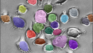 AI Algorithm Enables Biological Imaging Breakthroughs