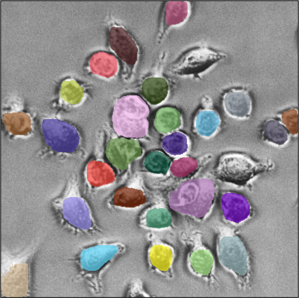 AI Algorithm Enables Biological Imaging Breakthroughs