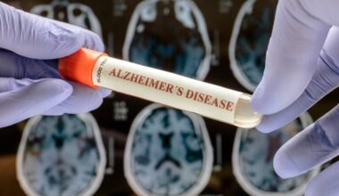 Developers back Alzheimer’s drugs despite report suggesting lack of efficacy