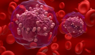Repurposed drugs could improve treatment for rare infant leukaemia