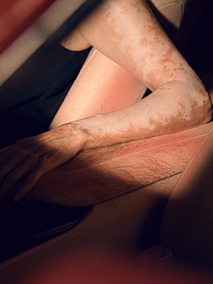 Close-up photo of a person's arm contrasted with the human-like skin of the Sunburnt Car, showing a section with long, sparse hairs