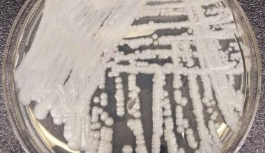 Scientists are nervous about drug-resistant fungi : NPR