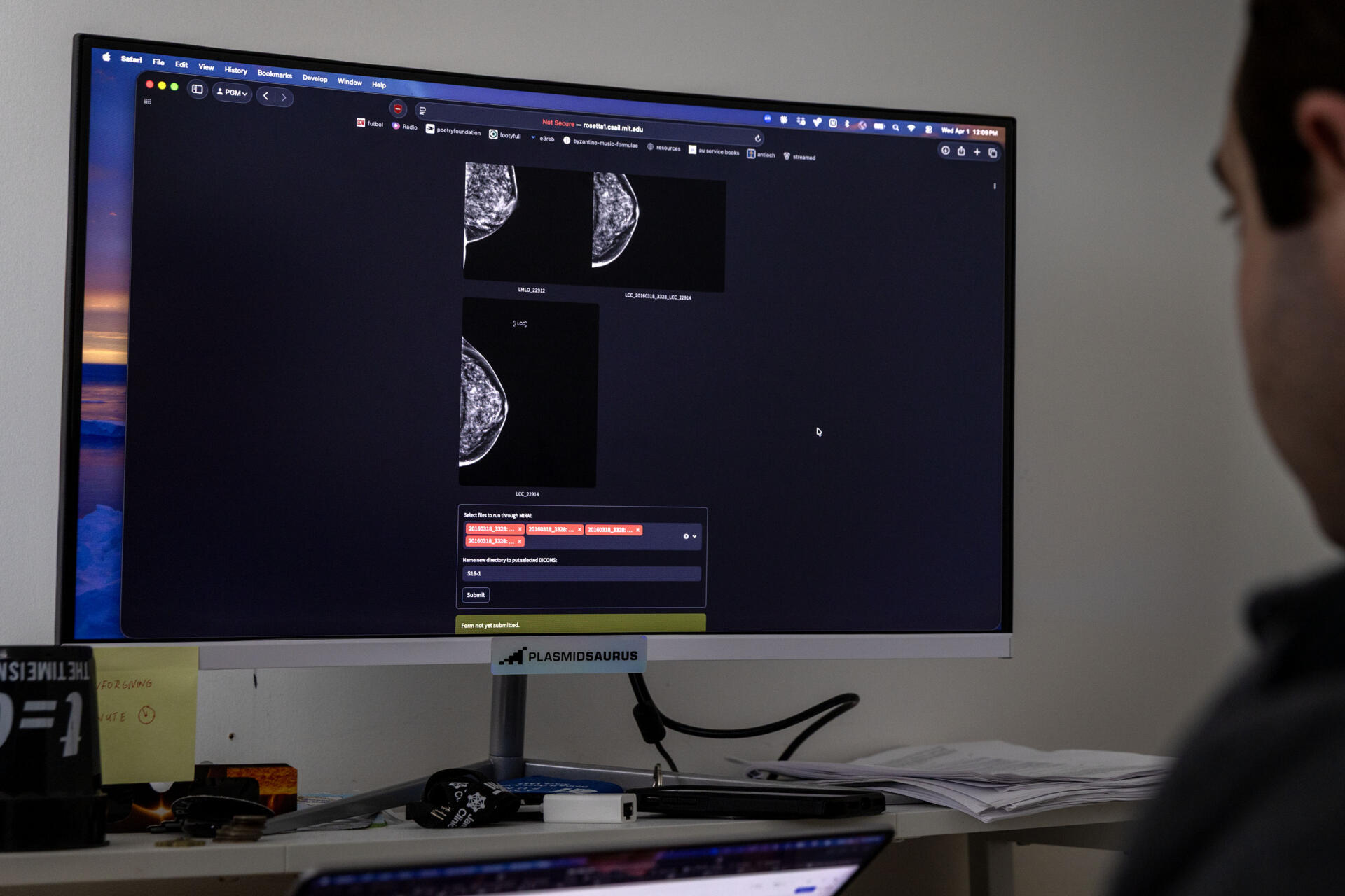 Peter Mikhael, a Ph.D. student at MIT, demonstrates how AI can analyze a breast x-ray in seconds. (Robin Lubbock/WBUR)