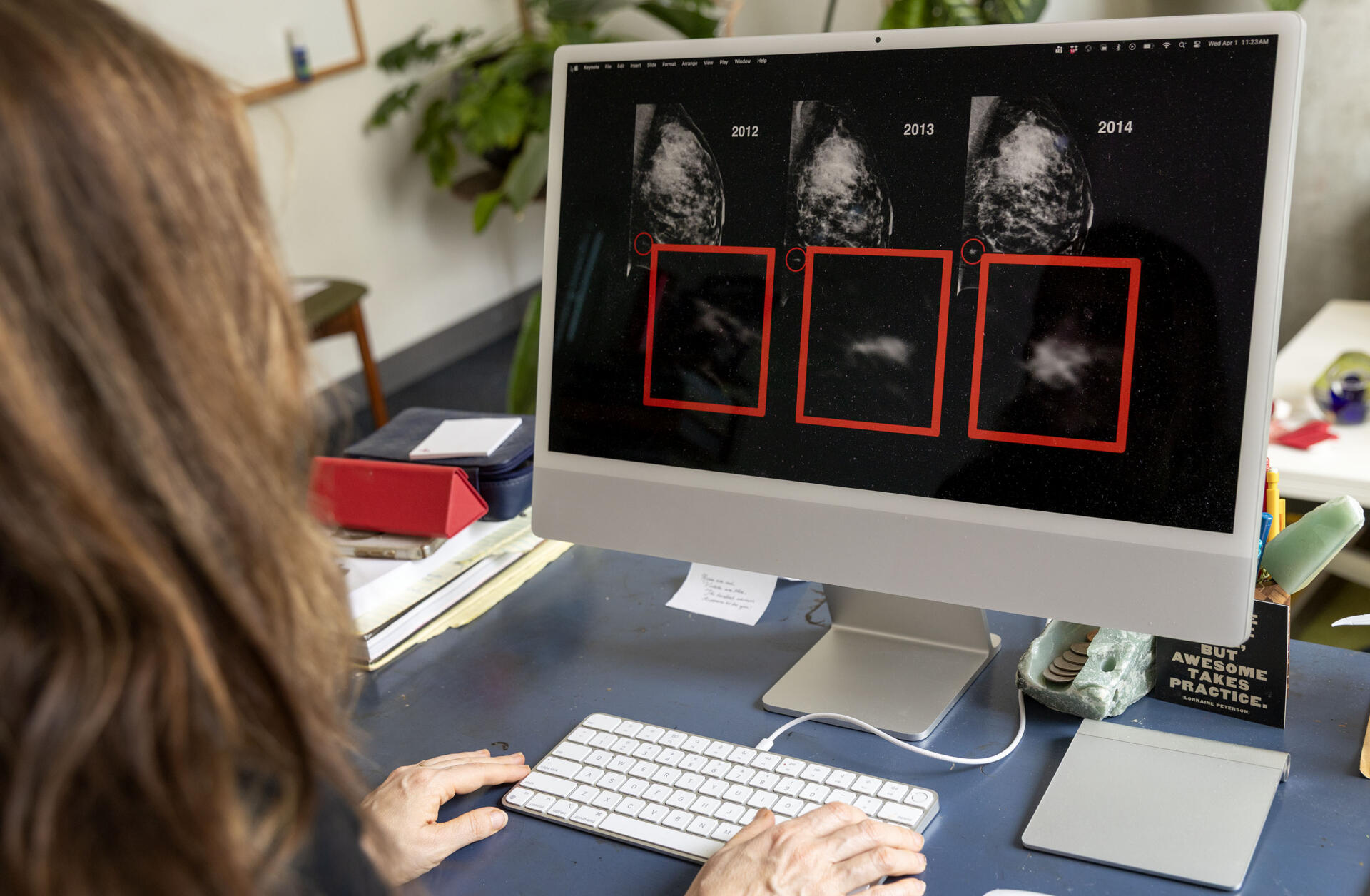 Regina Barzilay views images from her old mammograms. She says AI could see her cancer coming before doctors could. (Robin Lubbock/WBUR)