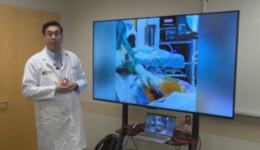 Less invasive spine surgery speeds up recovery time for patients, AHS says