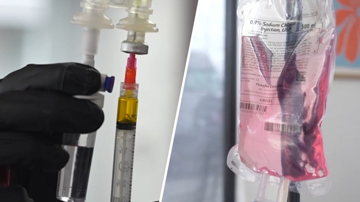 IV therapy, explained: it’s not just for hangovers anymore – NBC Boston