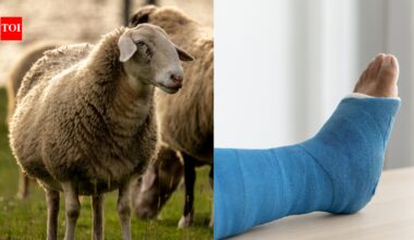 Scientists turn sheep wool into a bone-healing material in a major medical breakthrough |
