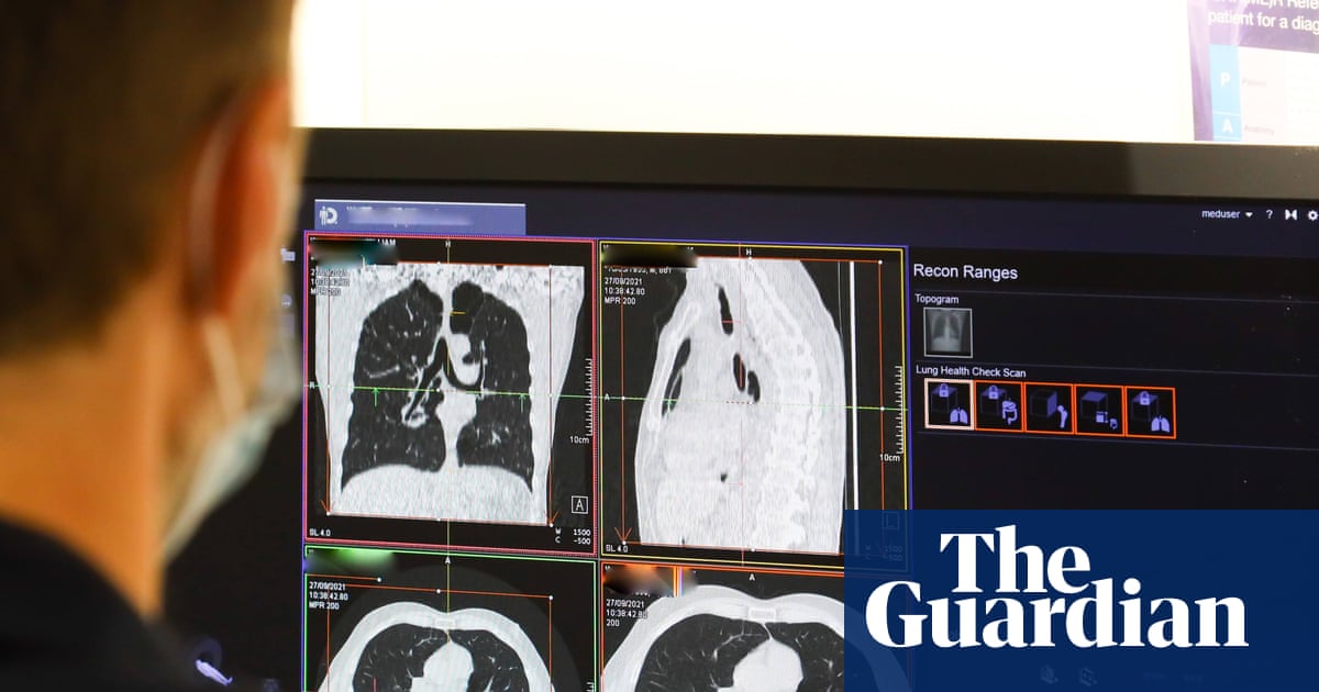 NHS spends record £241m outsourcing scan analysis to private firms | NHS