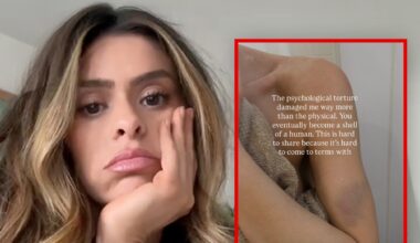 Taylor Frankie Paul Posts Bruised Arm, Opens Up About ‘Psychological Torture’