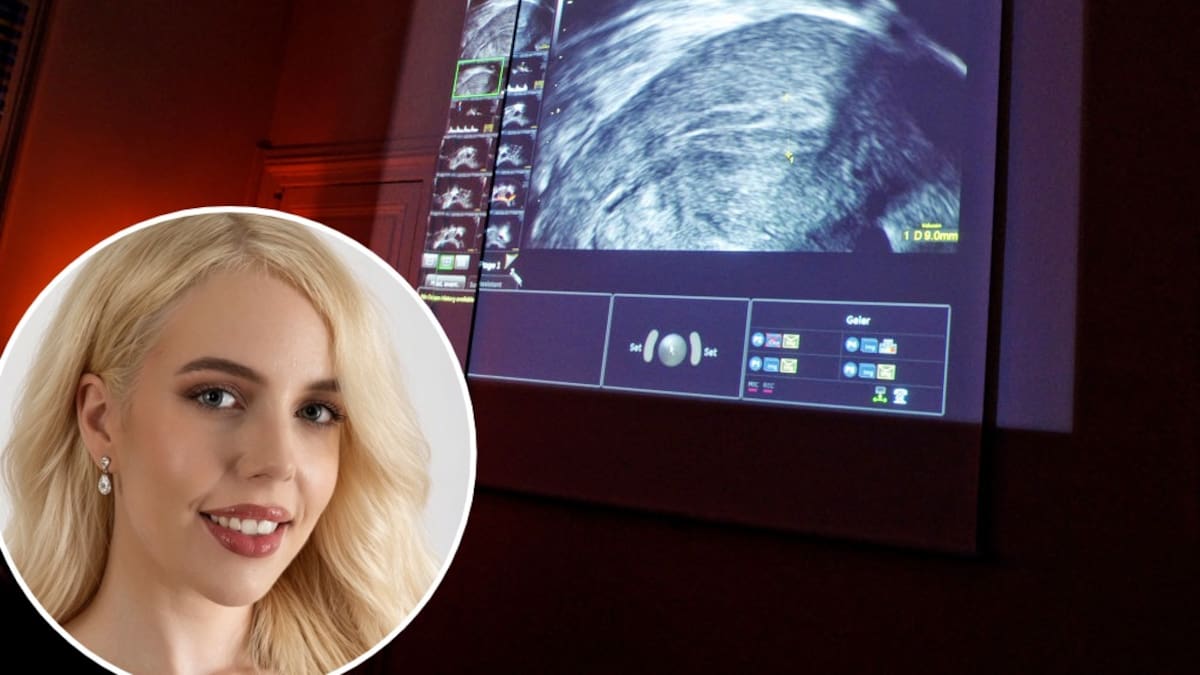 PCOS now PMOS: New Zealand advocates say clearer name will speed up diagnosis