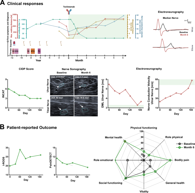 Fig. 3: Patient 2: Clinical responses and patient-reported outcome in refractory MAG neuropathy treated with teclistamab.