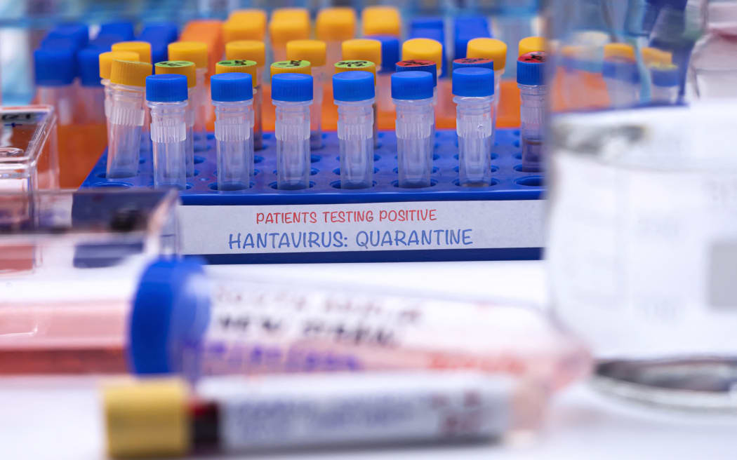 Positive hantavirus tests, conceptual image. (Photo by DIGICOMPHOTO/SCIENCE PHOTO LIBRA / FCA / Science Photo Library via AFP)