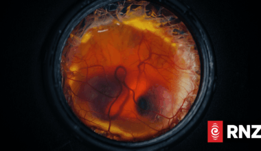 Colossal Biosciences says breakthrough means it's a step closer to resurrecting giant moa