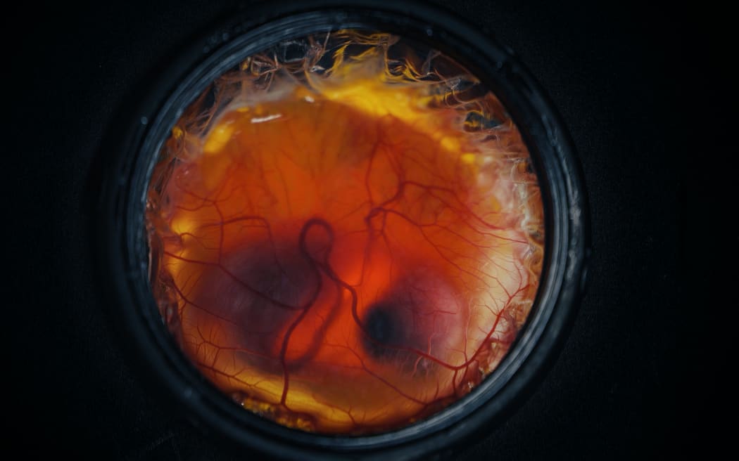 Embryo development.