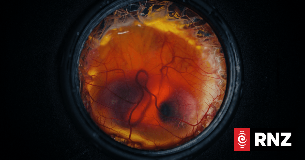Colossal Biosciences says breakthrough means it's a step closer to resurrecting giant moa