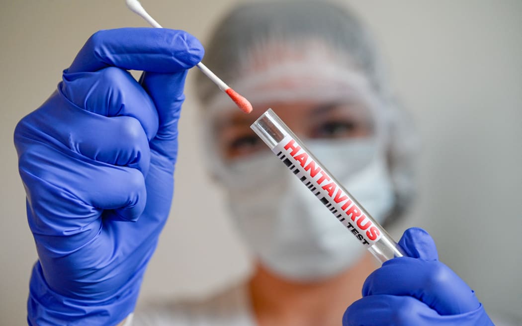 ILLUSTRATION of laboratory hantavirus testing concept with sample tubes and cotton swabs handled by a person wearing protective medical equipment photographed in Paris, France, May 8 2026. (Photo by Joao Luiz Bulcao / Hans Lucas via AFP)