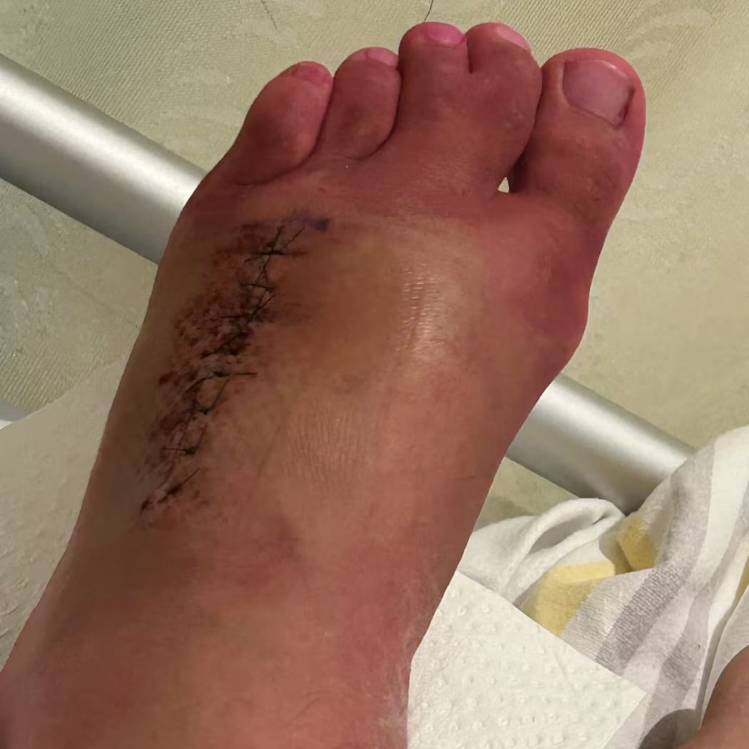 Tauranga Crown prosecutor Tobias Taane was barbed by a stingray at Papamoa Beach over Waitangi weekend, keeping him off his feet and out of court for two months.