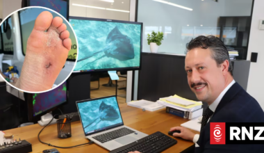Lawyer Tobias Taane's months-long recovery after stingray barb at Pāpāmoa beach
