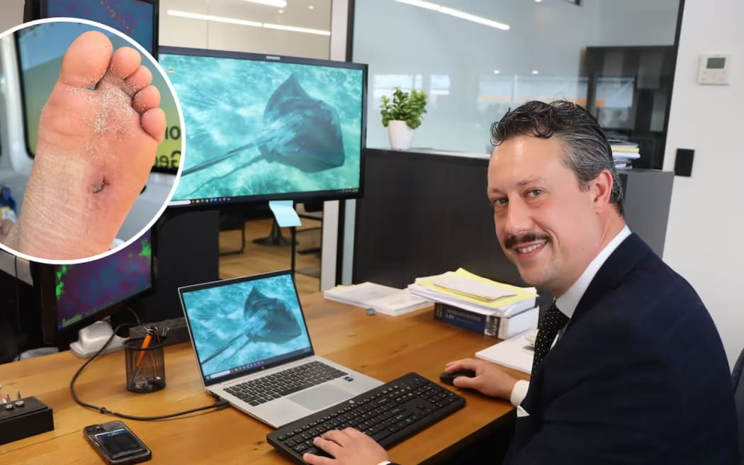 Prosecutor Tobias Taane was in the shallows at Papamoa beach when a stingray barb punctured his foot.