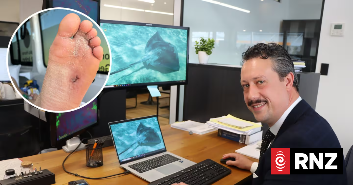 Lawyer Tobias Taane's months-long recovery after stingray barb at Pāpāmoa beach