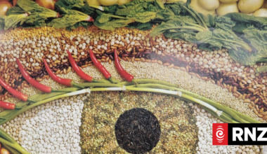 Parent of teen who only eats plain foods 'terrified' child could go blind