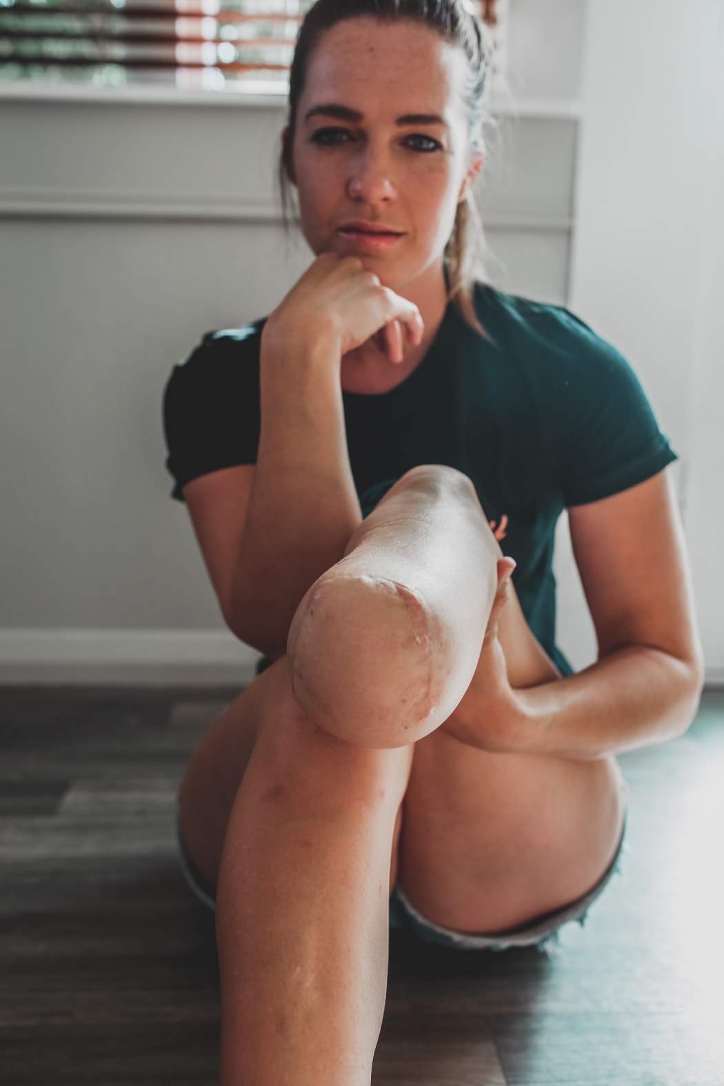 Rachel Maia post surgery