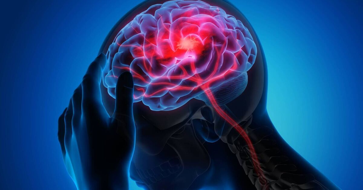 Incidents of stroke putting significiant pressure on Irish health system, Cork survey says