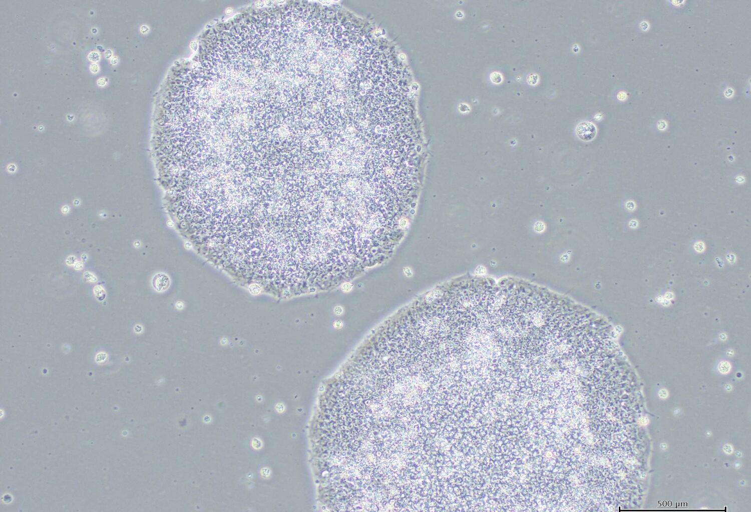 Health panel approves coverage for iPS cell-derived Parkinson’s disease treatment