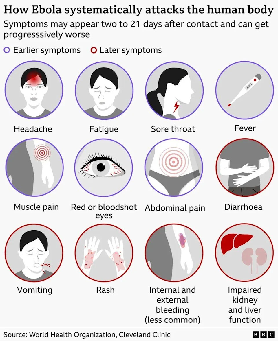 A BBC graphic explains Ebola's effects on the body