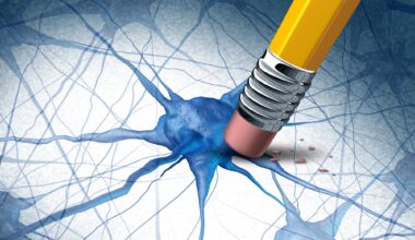 Alzheimers Dementia Brain Disease Concept