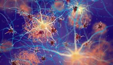 Amyloid Plaques Neurons Alzheimer