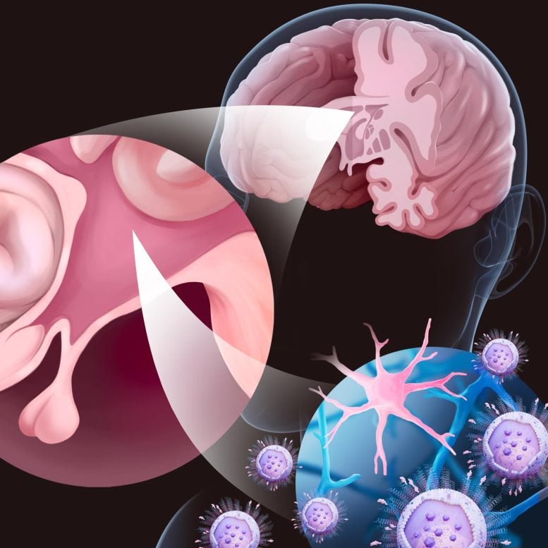 Anti Inflammatory Medicine Blood Brain Barrier