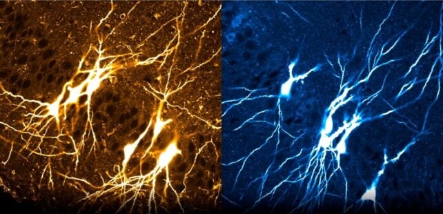 Our Brains May Be Born 'Full', Not as a Blank Slate