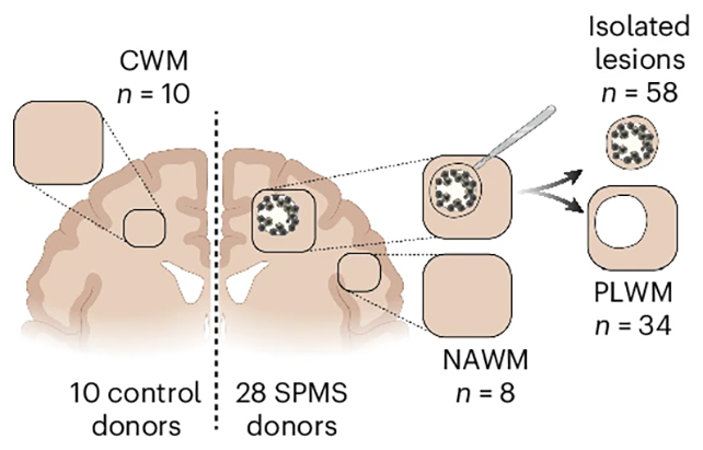 Brain tissue samples