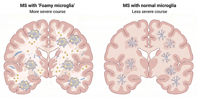 Microglia analysis
