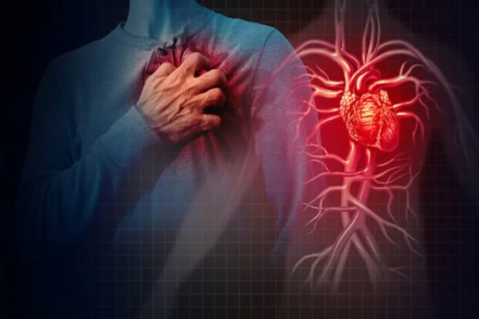 CARDIAC