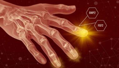 Conceptual Graphic of Hand Bone Regeneration With BMP2 FGF2