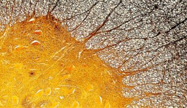 World MS Day: Immune Cell Discovery Might Explain Multiple Sclerosis at Its Worst : ScienceAlert