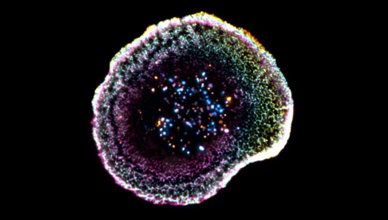 Cytotoxic T Cell