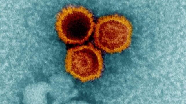Three orange cells grouped together, surrounded by blue 